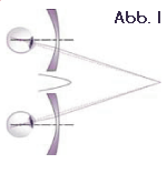 Abb1.
